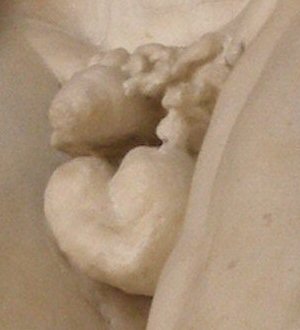 Laocoon's penis