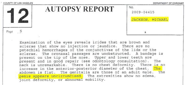 Michael Jackson's autopsy (detail)