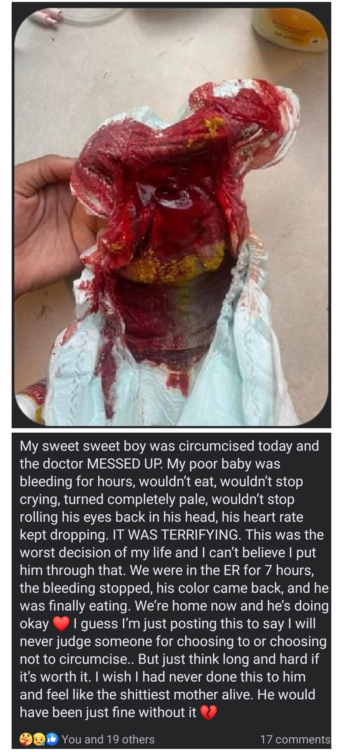 Image: a blood-soaked diaper Text: "My sweet seeet boy was circumicised today and the doctor MESSED UP. 
                               My poor baby was bleeding for hours, wouldn't eat, wouldn't stop crying, turned completely pale,                                wouldn't stop rolling his eyes back in his head, his heart rate kept dropping. IT WAS TERRIFYING. 
                               This was the worst decision of my life and I can't believe I put him through that.                                We were in the ER for 7 hours, the bleeding stopped, his colour came back, and he was finally eating. 
                               We're home now and he's doing okay [heart] I guess I'm just posting this to say I will neer judge someone                                for choosing to or choosing not to circumcise.. But just think long and hard if it's worth it. 
                               I wish I had never done this to him and I feel like the shittiest mother alive.                                He would have been just fine without it. [broken heart]