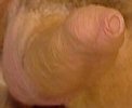 non-retracting foreskin-2; erect, still covering