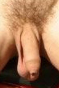 A loose foreskin