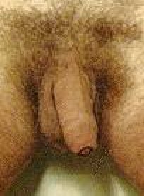 Hairy 1970's Man's penis